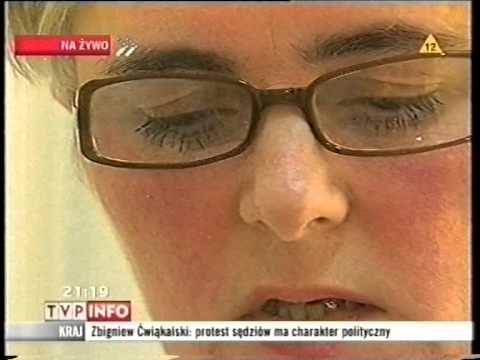 Koślawe zniekształcenie typów operacji kolana Laserowe usuwanie narośli na palcach