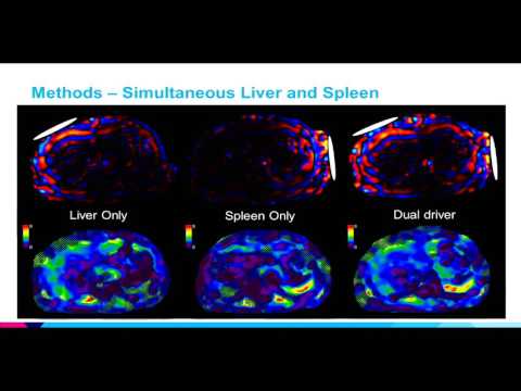 7th Annual TMII Symposium - 2017 - Session III - Cancer & Body Imaging - Dr. Paul Kennedy