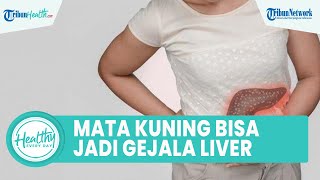 Waspadai Mata Kuning Bisa Jadi Gejala Penyakit Liver, Simak Ulasan dr Mustopa