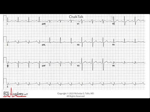 ECG 12-Lead Analysis – Advanced ChalkTalk #578