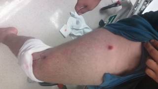 Original Upload, I Just Shot Myself!