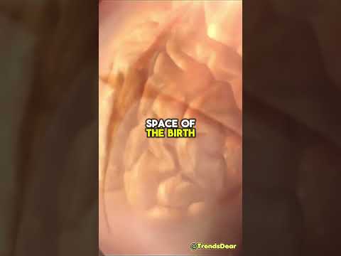 Pregnancy Trimesters Inside pregnancy Weeks 28 to 37 #Pregnancy #baby #Pregnant #weekbyweekpregnancy