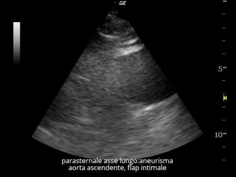 Dolore dei tacchi Omeopatia Hel per le articolazioni