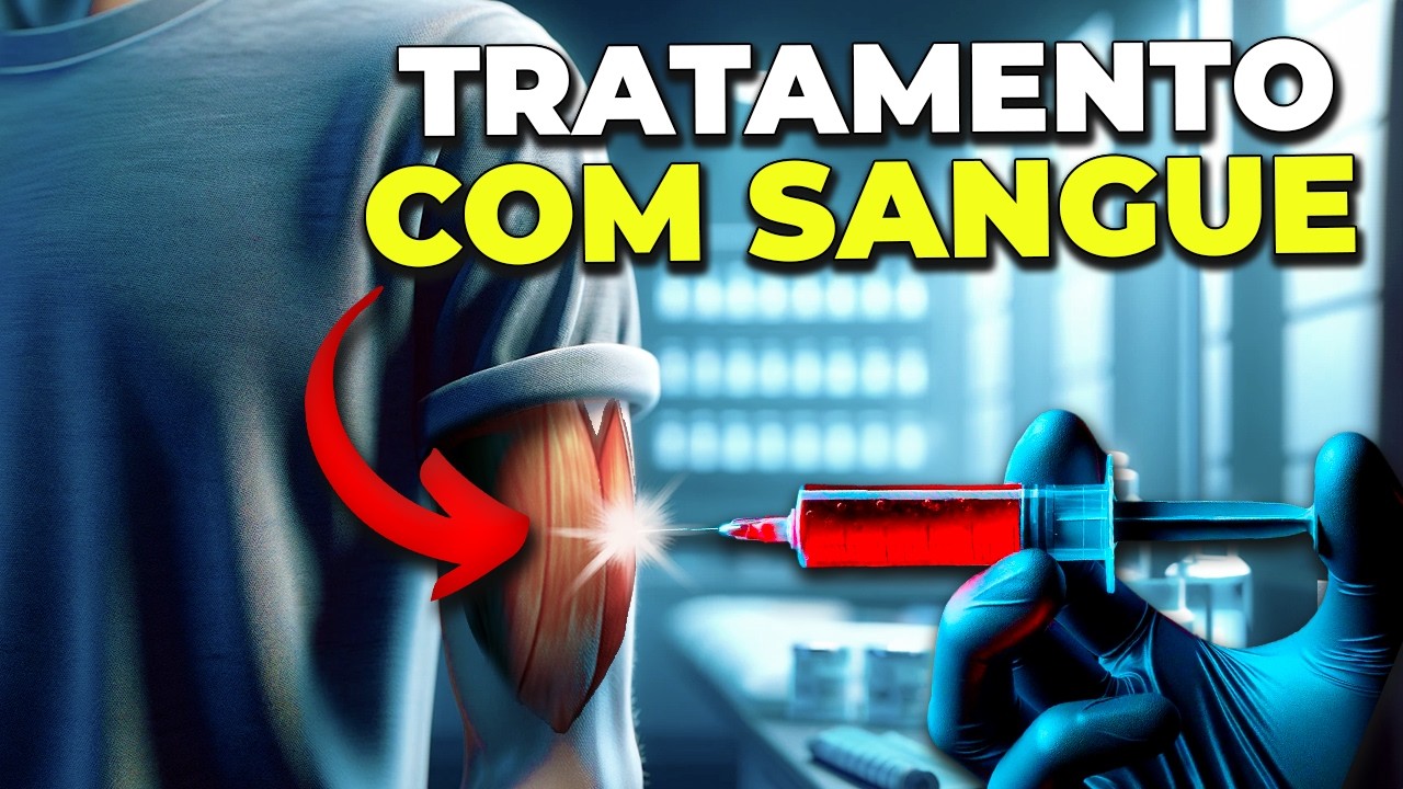 AUTO-HEMOTERAPIA: Injetar o Próprio SANGUE FAZ BEM?