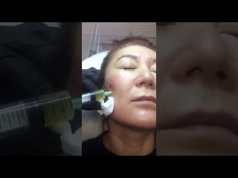 Instagram 2017 05 08 at 16 24 56