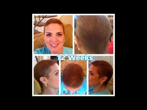 Hair Regrowth After Chemo