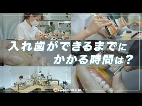 入れ歯ができるまでにかかる時間は？