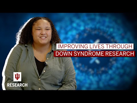 Improving lives of people with Down syndrome