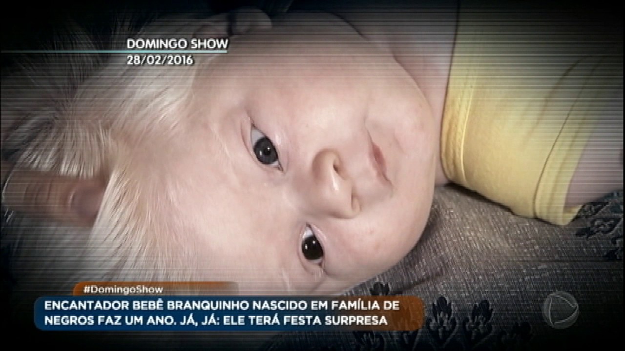 Saiba como vive o bebê albino que ficou famoso no Brasil