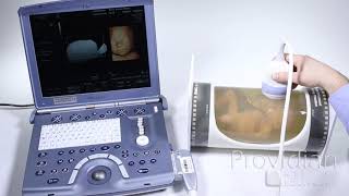 4D Ultrasound Training on Voluson and Other 4D Ultrasound Machines