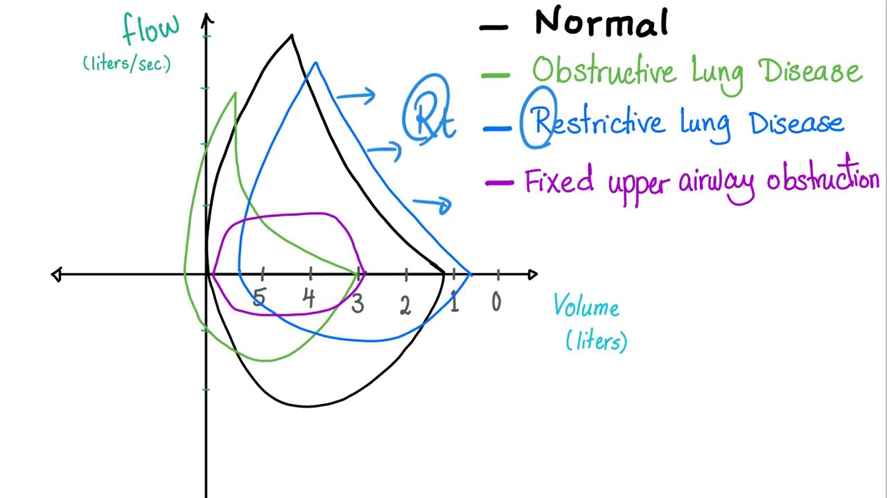 Flow Volume Loops - Respiratory Physiology - Pulmonary Medicine - Pulmonology Playlist