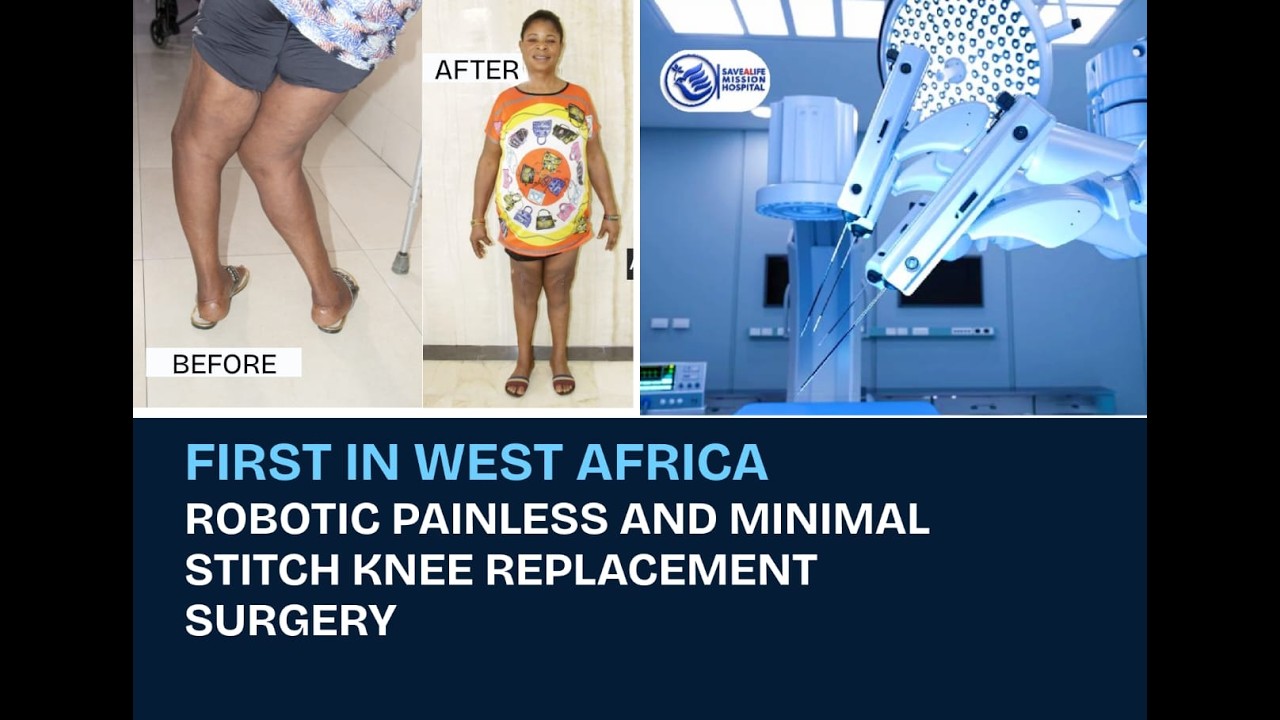 ROBOTIC PAINLESS AND MINIMAL STITCH KNEE REPLACEMENT SURGERY, First In Africa! thumbnail