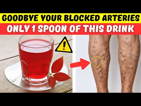 Over 50? Say Goodbye To Blocked Arteries with This Powerful Drinks