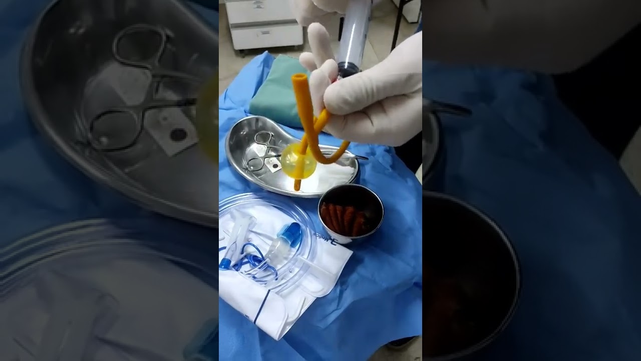Dr. Eduardo Gröhs | Médico urologista explica sobre o balonete da sonda vesical - bexiga