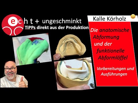 Von der anatomischen Abformung zum funktionellen Löffel