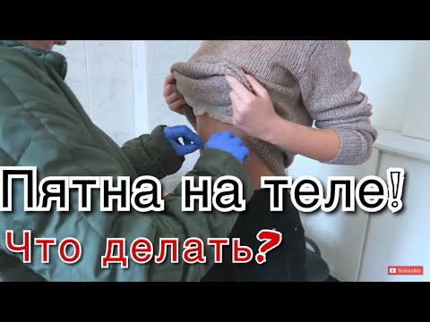 Грыжи в отделах шейных позвонков Рыбьим жир при остеохондрозе
