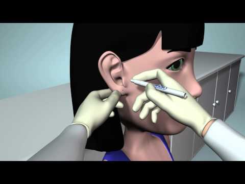 Caflon Blu Training Video