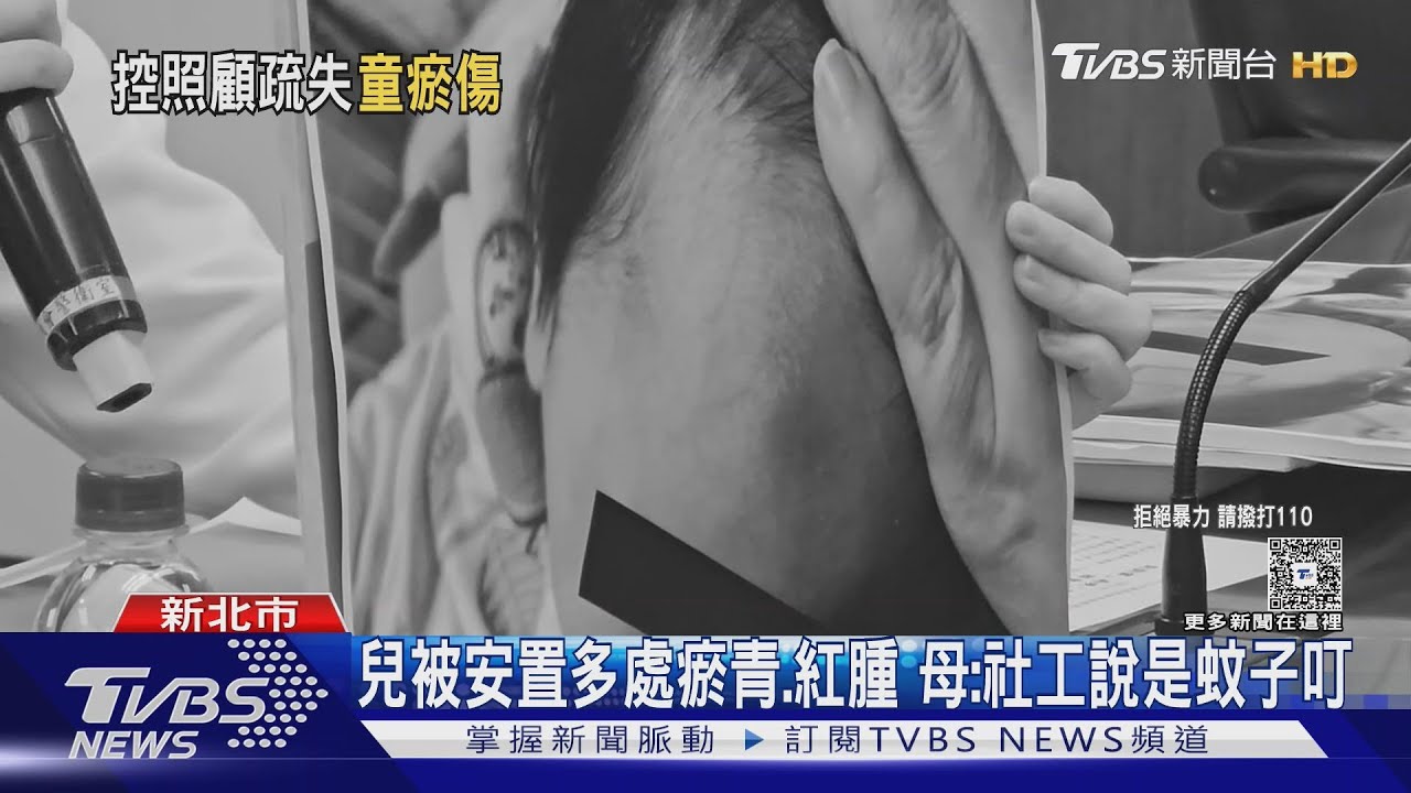 緊急安置10天 母淚控1歲兒「滿身傷」驗傷提告傷害