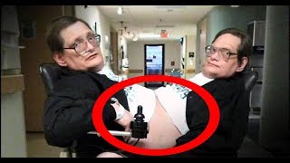 🔴 Os Casos Médicos mais Incríveis do Mundo! Irmãos Siameses!