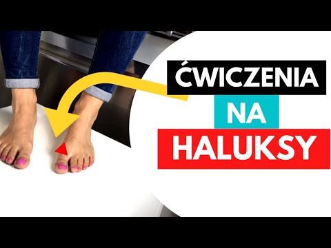 Dzieci koślawe stopy Ćwiczenia na nogi po operacji halyus koślawego