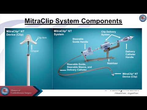 Transcatheter mitral repair: MitraClip technique