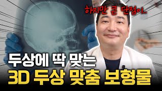 두상에 딱! 맞는 3D 두상 맞춤 보형물 | 하지만 큰 단점이...