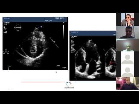 Webinar 7: Hypertrophic Cardiomyopathy, Case Based Discussion