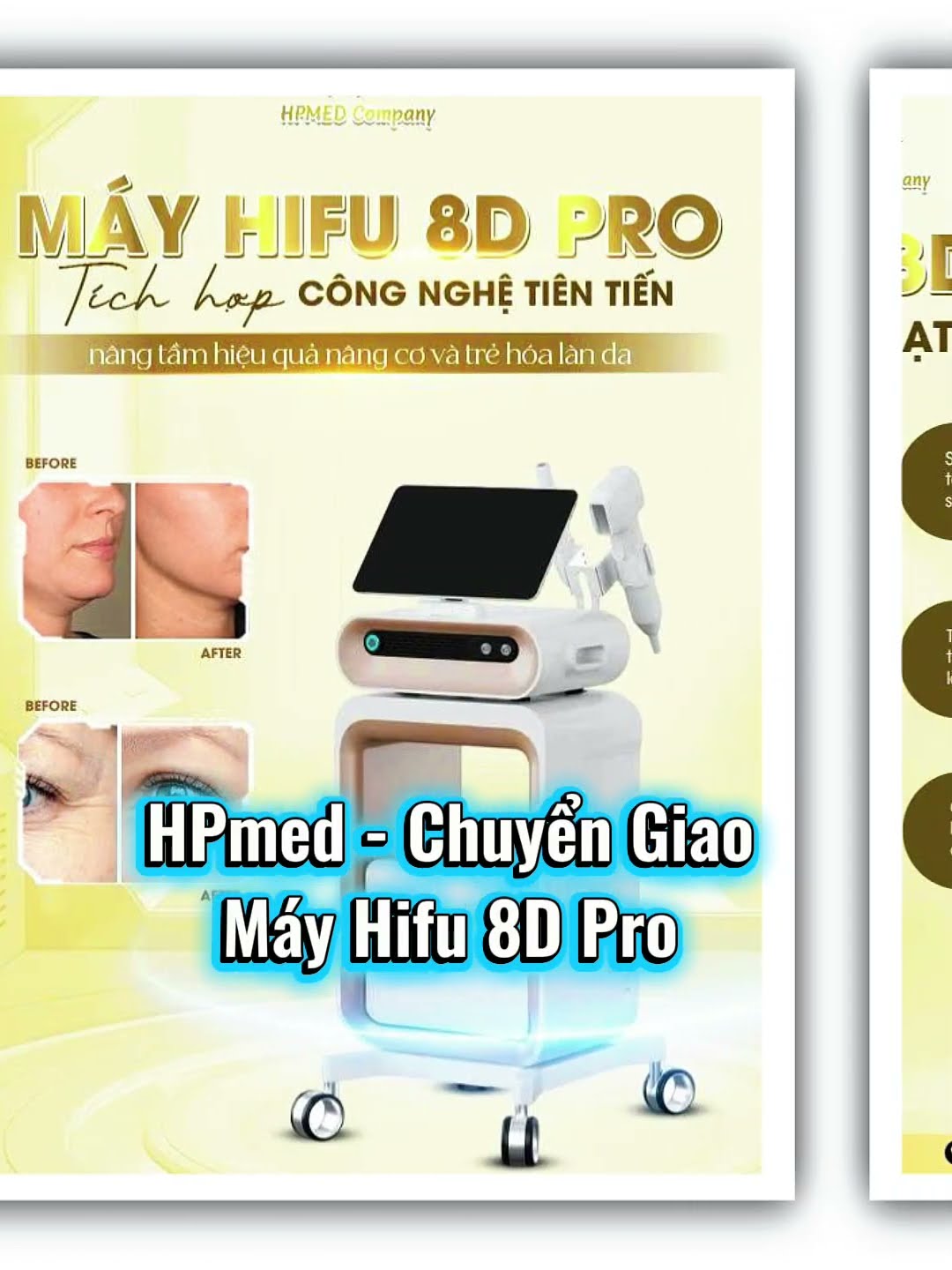 Thumbnail YouTube Shorts: Chuyển giao HIFU 8D Pro cho TMV SURIA – Cầu Giấy
