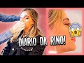 VOU FAZER MINHA CIRURGIA DE NARIZ Diário Da Rino BiaHerrero