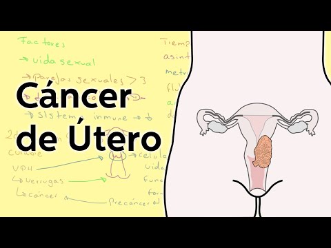Cervical cancer how to cure