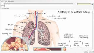 Allscripts MyWay EMR ENT and Allergy Demo