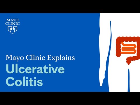 Mayo Clinic Explains Ulcerative Colitis