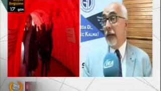 Türk Gastroenteroloji Derneği projesi Edirne'de. 24 TV Haberi