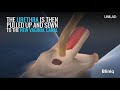 Sex Reassignment Surgery Male To Female At Bliniq Cosmetic Surgery Centre And Medspa