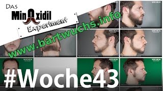 Das Minoxidil Experiment #Woche43 Fortschritte mit Bartwuchs.info
