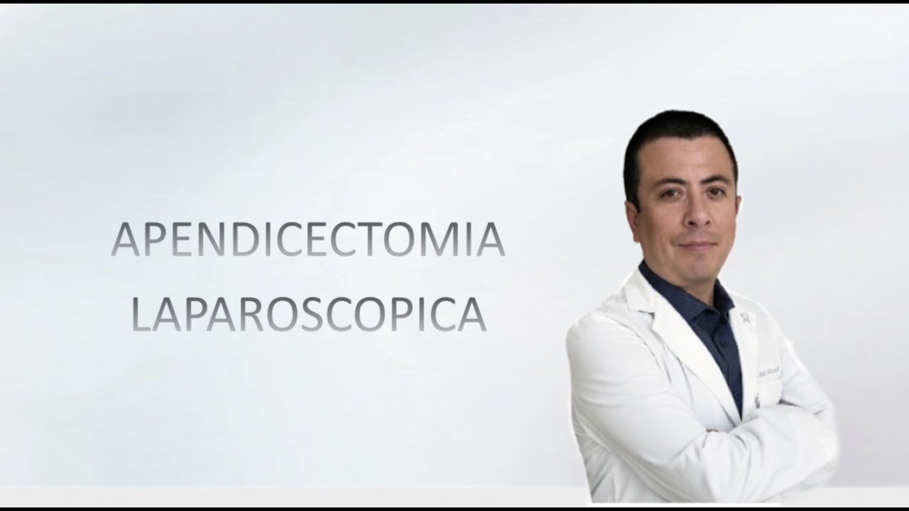 Edgar Martin Villanueva Castillo-10