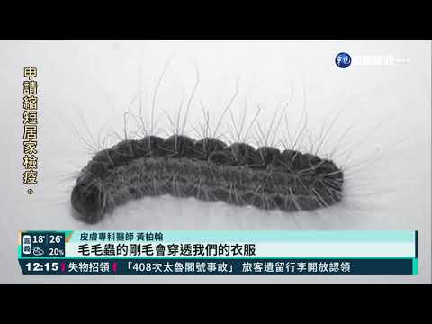 女童大腿起疹子 毛毛蟲剛毛導致過敏