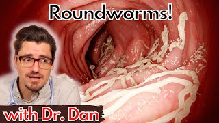 Roundworms in the Dog.