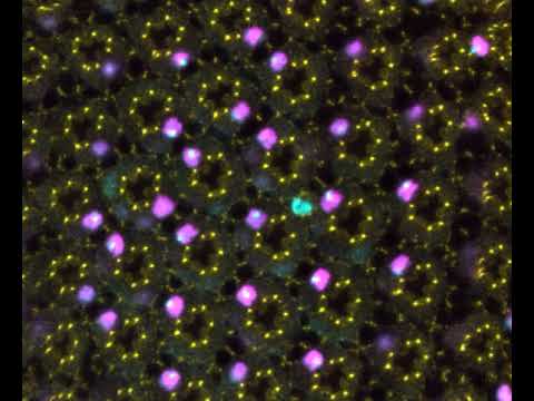 Seeing through a fly's eye, by Francisco Javier Bernardo Garcia