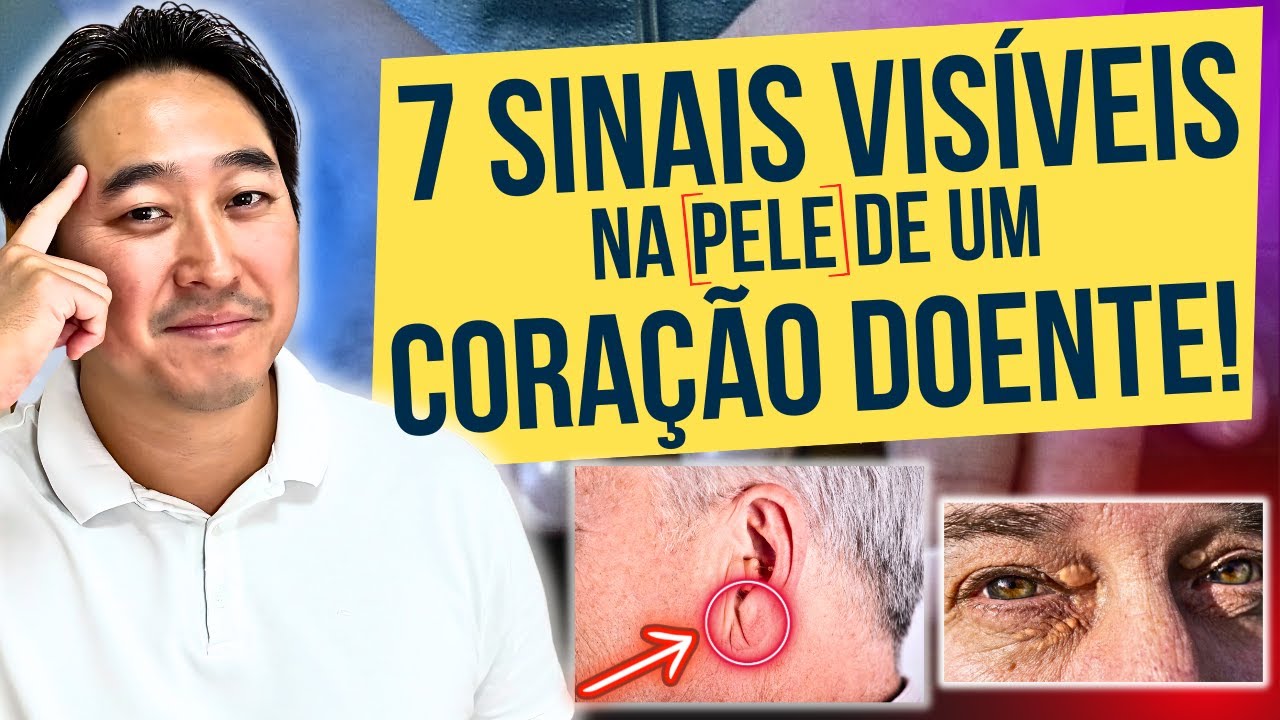 7 SINAIS VISÍVEIS NA PELE DE UM CORAÇÃO DOENTE!