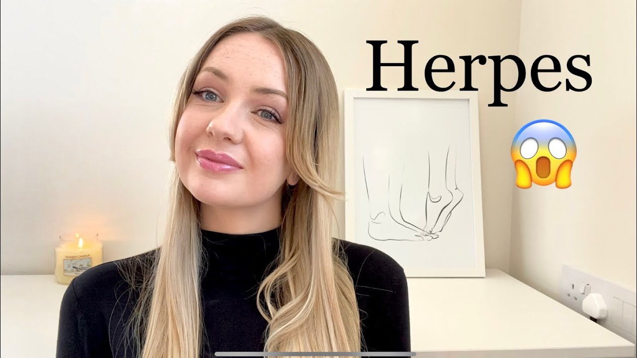 Can you Get Rid of Herpes? Sexual Health Nurse Hannah