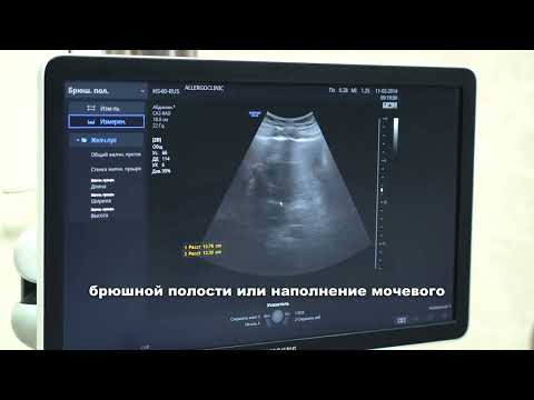 Ультразвуковое исследование 