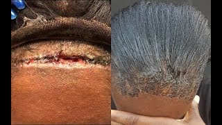 MUST WATCH!! SCALP FOLLOWED LACE WIG -  DESTRUCTIVE HAIRSTYLES