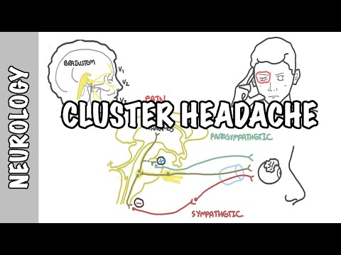 Klasterowe bóle głowy - objawy, patofizjologia, leczenie