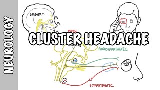 Cluster Headaches - symptoms, pathophysiology, treatment