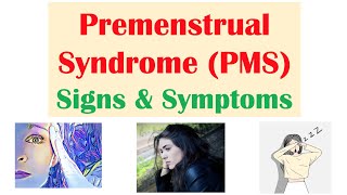 Download lagu Premenstrual Syndrome (PMS) Signs & Symptoms | & Why They Occur mp3