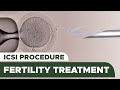 Fertility Treatment: Intracytoplasmic Sperm Injection (ICSI) Procedure