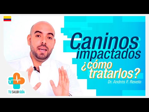 Caninos Impactados | Tu Salud Guía