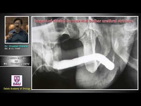 Lecture 2 On Male Urethrogarphy