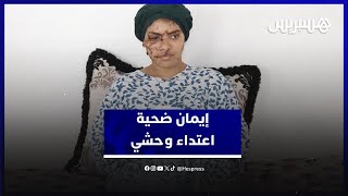 إيمان ضحية جديدة للعنف الزوجي بتازة.. طليقها يعتدي عليها بشكل وحشي thumbnail
